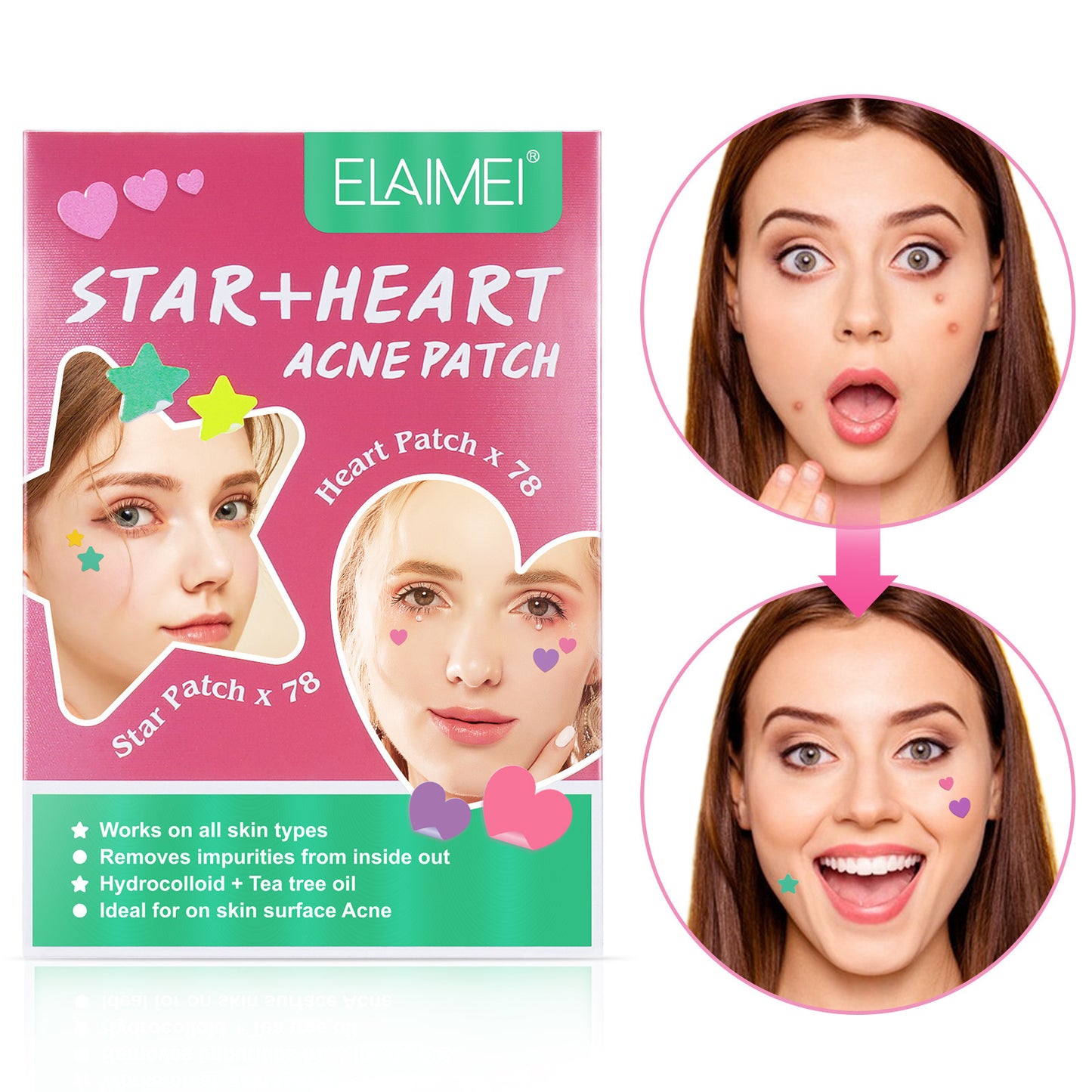 Peach Heart Color Multi-shape Acne Patch
